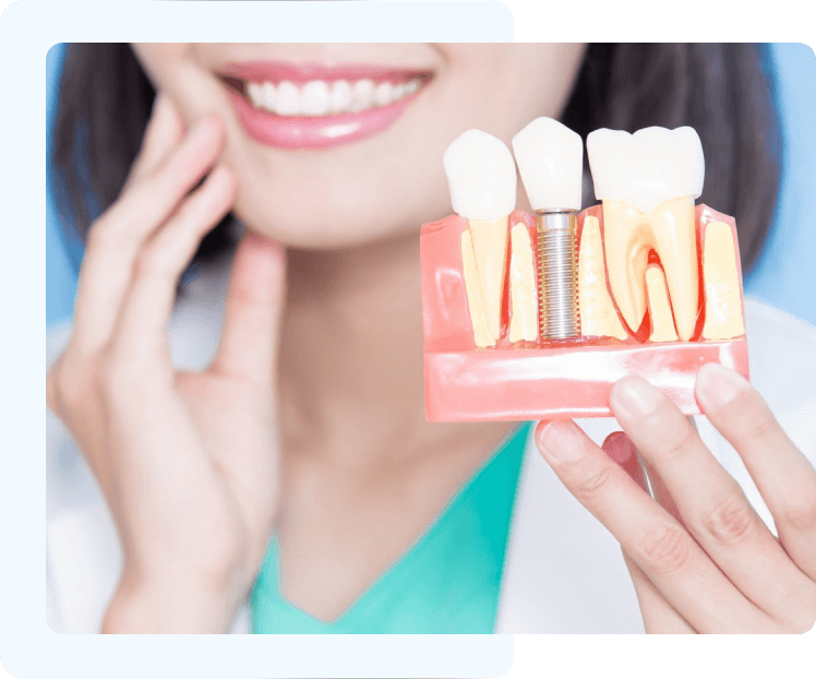 What Is A Dental Implant