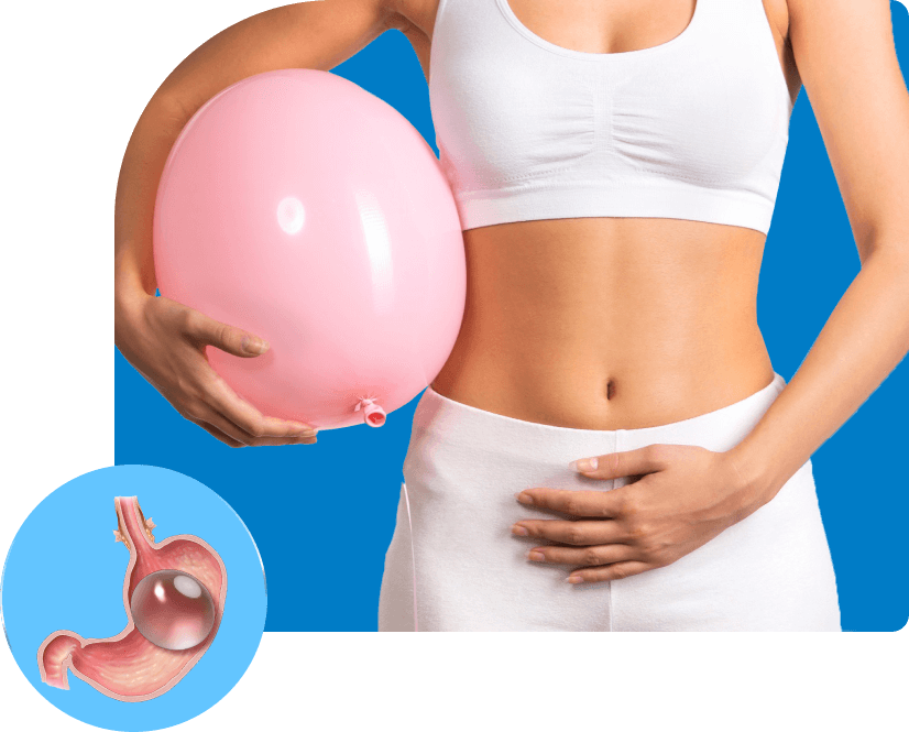 gastric balloon