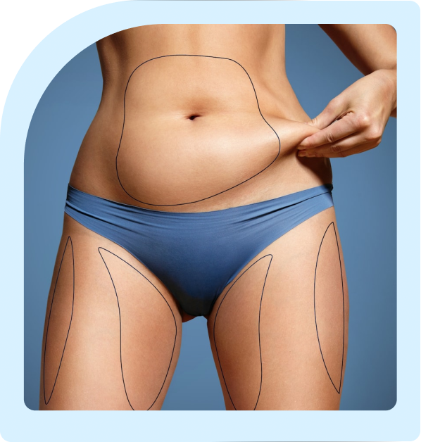 what are the types of liposuction