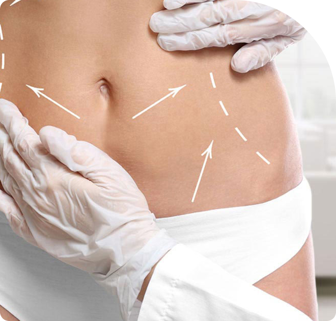 In Which Areas Can Liposuction Be Applied