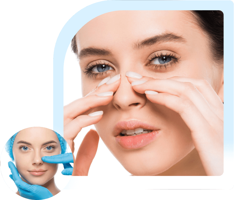 rhinoplasty