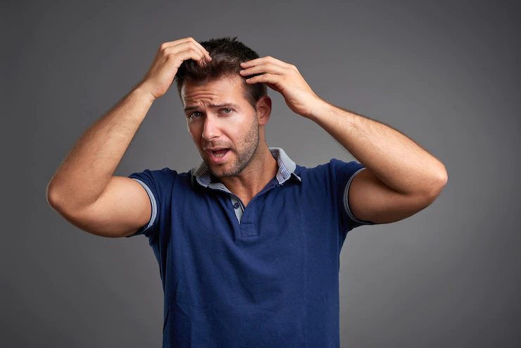 Man before Hair Transplant in Turkey