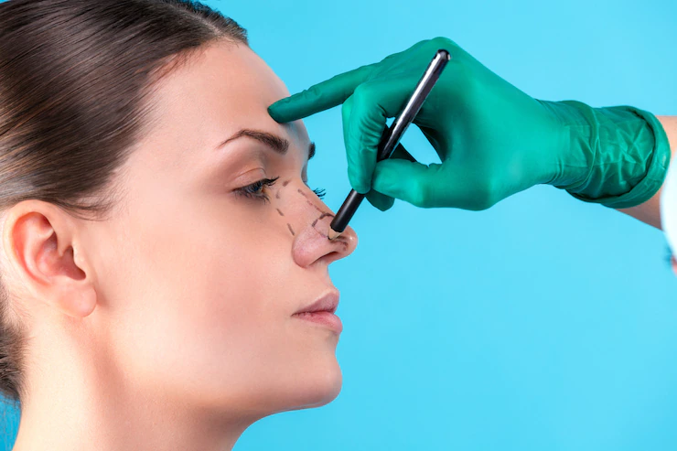 A patient getting her nose marked by a rhinoplasty surgeon