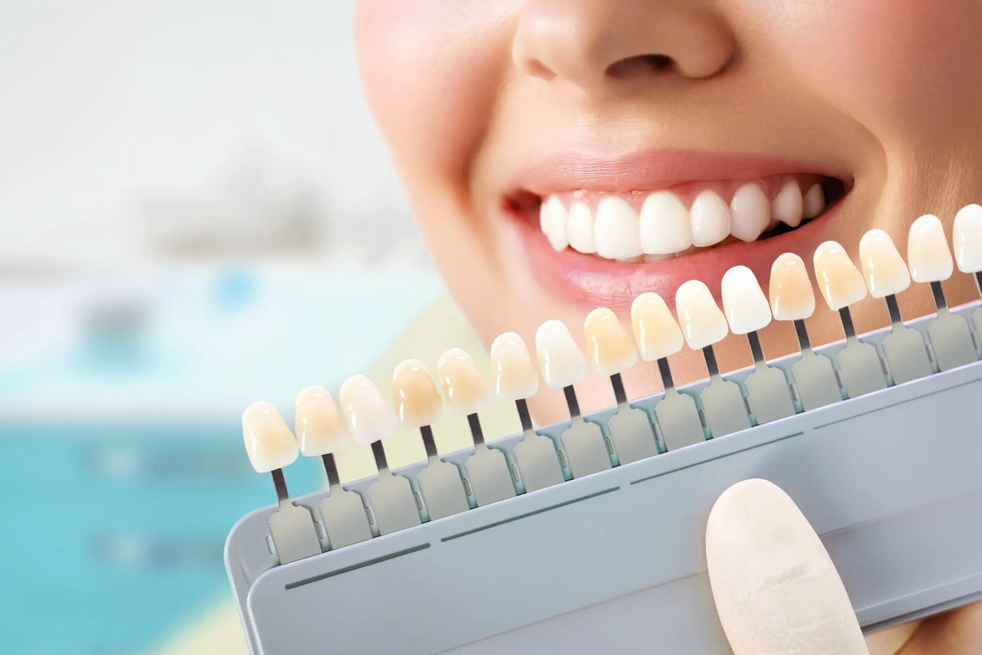 A female patient behind a zirconium veneer set