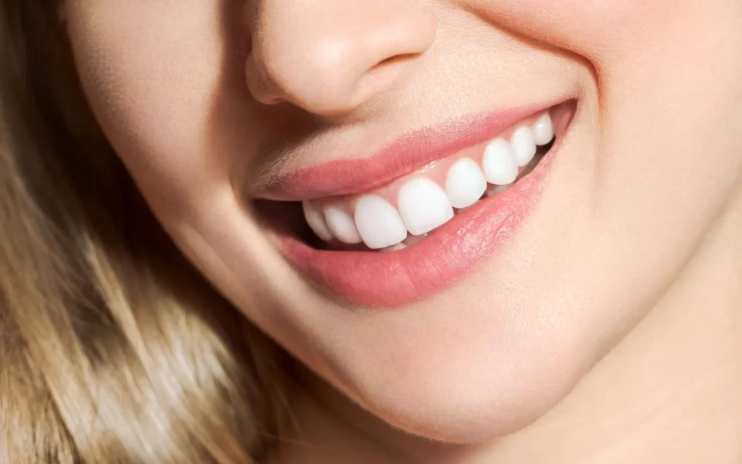 Zirconium Veneers vs. Porcelain Veneers: Which One Is Better?