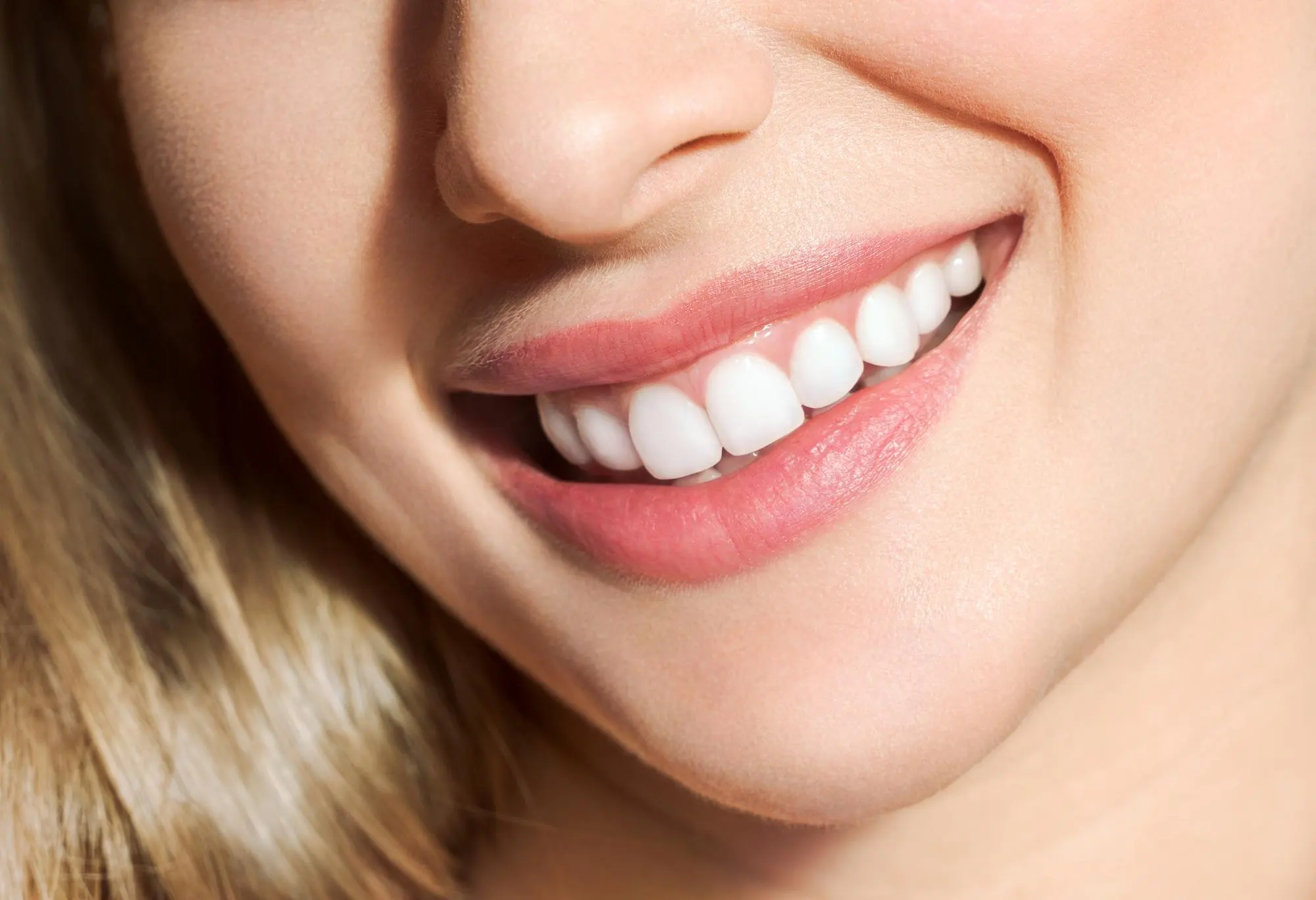 woman-patient-shown-veneers