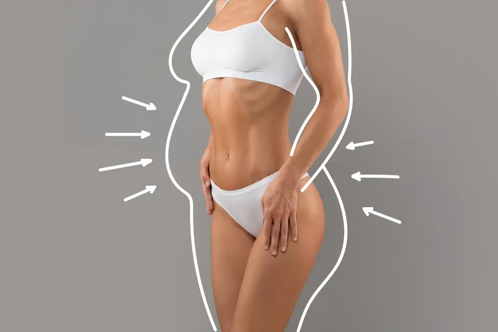 Alt text: liposuction with arrows around slim female body white underwear